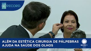 ALÉM DA ESTÉTICA CIRURGIA DE PÁLPEBRAS AJUDA NA SAÚDE DOS OLHOS [upl. by Eillor]