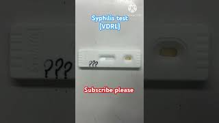 How to perform syphilis VDRL testing lab vdrl test lab technician bloodtest viralshorts labs [upl. by Garv]