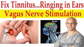 Fix Tinnitus Ringing in Ears Major Breakthrough How to Stimulate Vagus Nerve  Dr Alan Mandell DC [upl. by Chui1]