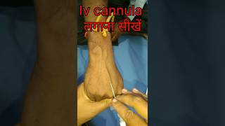 Iv cannulation technique mbbs motivation nursing viralvideo shorts [upl. by Trudi]