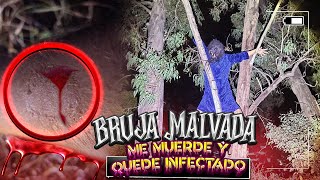 BRUJA MALVADA ME MUERDE Y QUEDO INFECTADO [upl. by Dunstan]