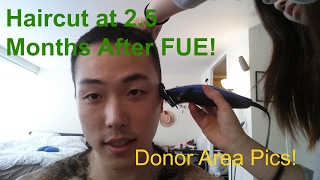 Haircut 25 Months After Hair Transplant  Donor Area [upl. by Hagerman93]