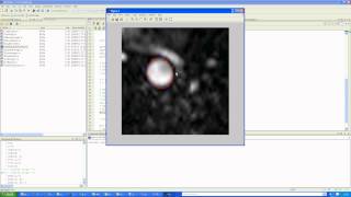 How to use the Flow Image Processing Toolbox in Matlab [upl. by Nereen922]