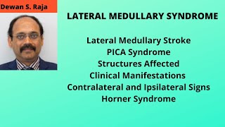 Wallenberg Syndrome Lateral Medullary Syndrome [upl. by Warton]