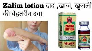 zalim lotion lagane ka sahi tarika  fayda Nuksan Dose side effects  zalim lotion review [upl. by Aserehs427]