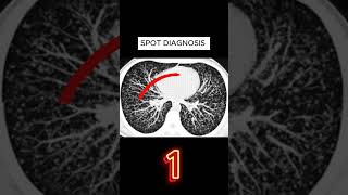 X ray quiz 32 nursing nursingstudent doctor USMLE MBBS hospital anatomy ctscan radiology [upl. by Ner64]