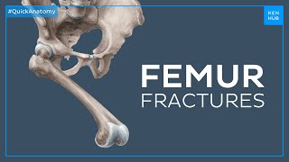 What happens when you fracture your femur  Quick Anatomy  Kenhub [upl. by Naneik688]