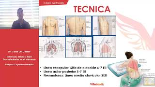 CLASE Nº8  Toracocentesis [upl. by Ennovihs457]