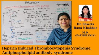 Heparin Induced Thrombocytopenia Syndrome Antiphospholipid antibody syndrome  Thrombosis [upl. by Preuss911]