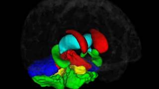 Brain Morphometry  Brain Image Analysis [upl. by Heimlich857]