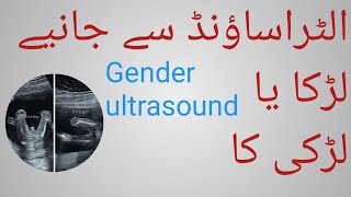 Ultrasound reveals baby journeyGender determination ultrasoundbabyobs youtubegenderpregnancy [upl. by Ellehsram]