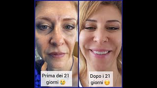 ORMONI IN FUGA Il primo Videocorso di Nutrizione antiaging con dieta di 3 settimane [upl. by Nyleikcaj]