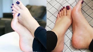 Ravishing designs of best toe nails pedicure colors Freshly done pedicure fashion trends of 2024 [upl. by Nyre]