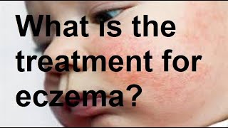 What is the treatment for eczema [upl. by Tanberg]