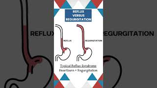 Reflux and Regurgitation  Understanding the difference biology medicalcondition [upl. by Onstad2]