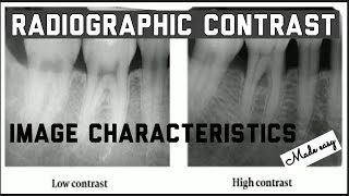 RADIOGRAPHIC CONTRAST II IMAGE CHARACTERISTICS II IDEAL RADIOGRAPH II ORAL RADIOLOGY [upl. by Araccot]