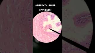 Epithelial tissue histology slides Pathology part 1 [upl. by Affer965]