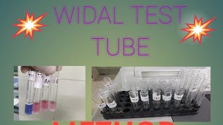 WIDAL TEST TUBE METHOD [upl. by Adur]