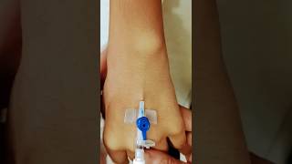 IV Cannula insertion technique ivcannulation shortvideo trendingshorts [upl. by Yracaz]