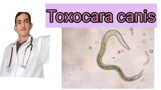 Toxocara canis toxocarose [upl. by Retsev]