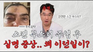 스킨부스터 주입 후 실명 부작용 스킨부스터의 숨겨진 위험 [upl. by Crispin]