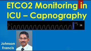 ETCO2 Monitoring in ICU – Capnography [upl. by Mandych]