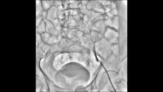 Radiography amp Fluoroscopy Systems  RSMDSA [upl. by Ha]