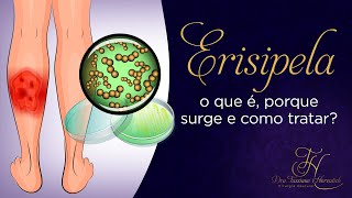 Erisipela o que é porque surge e como tratar [upl. by Hesper]