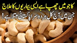 Benefits Of Cashew  Kaju K Fayde Urdu Hindi [upl. by Osterhus]