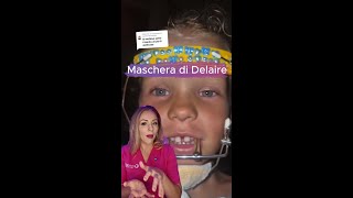 🦷 Cosè la Maschera di Delaire 🎥 [upl. by Hallie474]