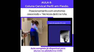 Cervical Perfil em Flexão tecnciasradiologicas radiologia [upl. by Larentia]