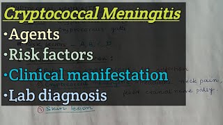 Cryptococcal meningitis  Agents  Risk factors  Clinical manifestation  Lab diagnosis [upl. by Nyasuh131]