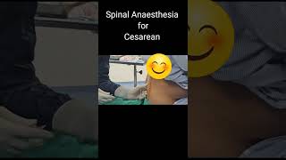 सीजेरियन में कमर में सुई लगाकर कैसे बेहोश करते हैं  Spinal Anaesthesia by Dr Manoj Kathariya [upl. by Tillford]