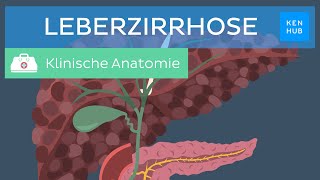 Leberzirrhose Ursachen Symptome Diagnose Behandlung  Kenhub [upl. by Oinafipe]