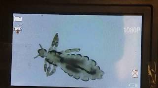 Head lice die in dimethicone  Lice Ninjas [upl. by Jacey229]