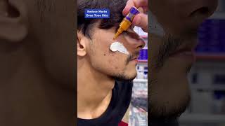 Glow amp Clean Anti Marks Cream Amazing Result ameenbeautytips GlowAndCleanByAmeen [upl. by Attenod]