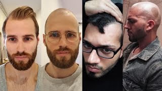 BALDING MEN EMBRACE GOING BALD  BaldCafe Head Shave INSPIRATION [upl. by Onirefez]