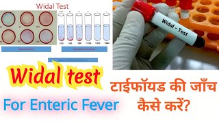 Widal test in hindi [upl. by Ellette]