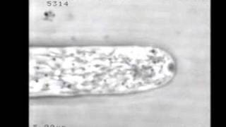 Cytoplasmic contractions in growing fungal hyphae and their morphogenetic consequences [upl. by Gonagle]