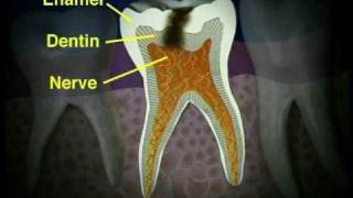 Pediatric Pulpotomy [upl. by Dasa]