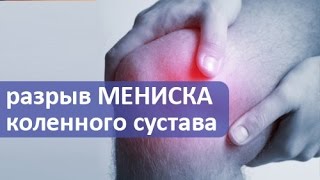 Разрыв мениска коленного сустава Лечение разрыва мениска коленного сустава операция [upl. by Eeral]