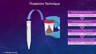 Concentration techniques in Stool  Floatation techniques  Sedimentation techniques  parasites [upl. by Olocin123]