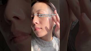 Healthy skin barrier 101 shorts skincareroutine skinbarrierrepair [upl. by Joacima]