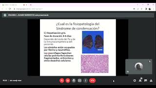 FISIOPATOLOGIA DE LOS SÍNDROMES DE CONDENSACIÓN PULMONAR Y NEUMONÍAS [upl. by Presber]