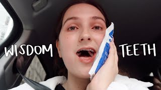 GETTING MY WISDOM TEETH REMOVED  vlog  storytime [upl. by Eliott]