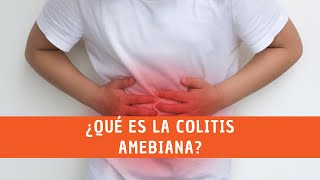 ¿Qué es la colitis amebiana [upl. by Pruchno]