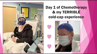 Day 1 of AC chemotherapy amp my TERRIBLE cold cap experience [upl. by Narok]