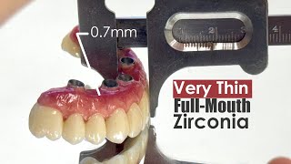 Making a 07mm FullMouth Zirconia Restoration [upl. by Pembroke]