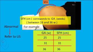 Symphysis Fundal Height  SFH  measurement [upl. by Iggy]