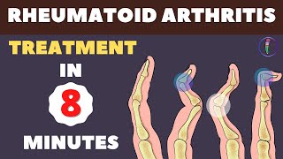 Rheumatoid Arthritis Treatment  New Medicines and Updates [upl. by Vi105]